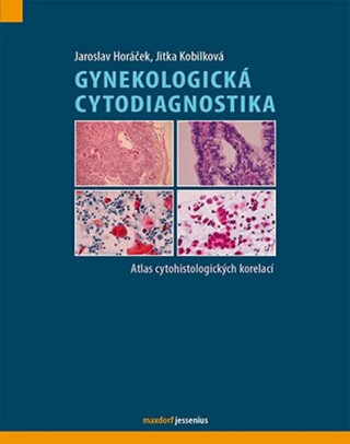 Gynekologická cytodiagnostika - Jitka Kobilková,Jaroslav Horáček